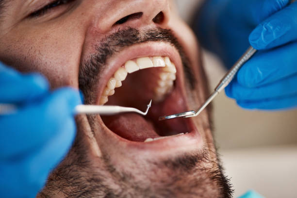 Best Broken Tooth Emergency  in Selbyville, DE
